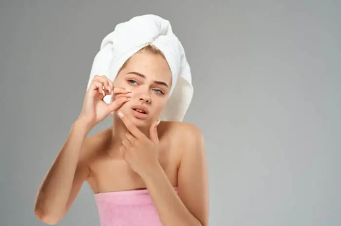 Fast and Effective Way to Get Rid of Acne